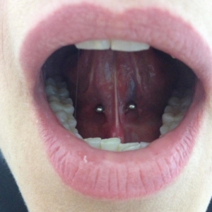 zungenbandpiercing tongue web